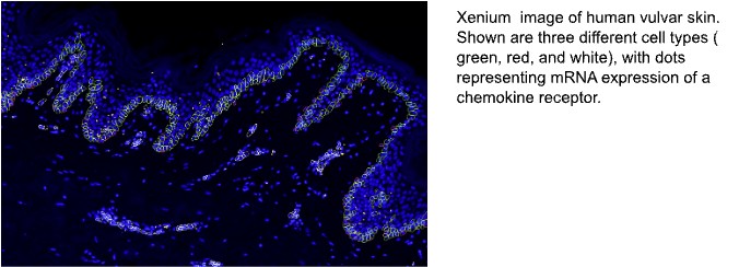 vulvar skin spatial transcriptomics